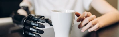 Protézy horních končetin